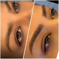 مدل میکروبلیدینگ