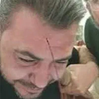 سرم تراپی،حجامت وفصدخون،بخیه وسونداژ