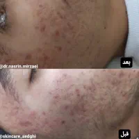 نیازمند همکاری با سالنهای ارایشی