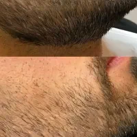 جشنواره پاییزه کلیه ی خدمات زیبایی کلینیک راز|خدمات آرایشگری و زیبایی|قم, شهرک قدس|دیوار