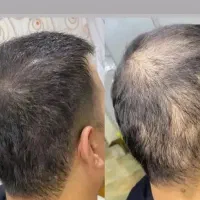 شامپو اصل مورینگاه