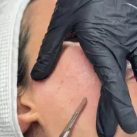 آف ویژه اصلاح درما
