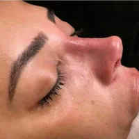 با ماهی ۵ میلیون بینی عمل کن