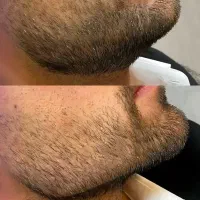 جشنوار ۵۰درصد ژل و بوتاکس دکتر محمدشریفی|خدمات آرایشگری و زیبایی|قم, زنبیل آباد|دیوار