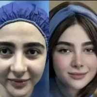 عمل بینی/رینوپلاستی/جراحی بینی/دکتر بختیاری