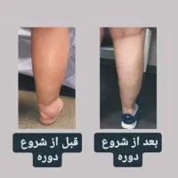 درمانگر بیماری روماتیسم و درد مفاصل|خدمات آرایشگری و زیبایی|اصفهان, شهرک سلامت|دیوار