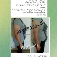 لاغری اصولی|آرایشی، بهداشتی، درمانی|کوهدشت, |دیوار