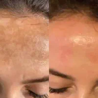 کرم روشن کننده پوست