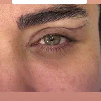بلفارو پلک فیلر ژل لب ساکشن غبغب بوتاکس نخ سانترال|خدمات آرایشگری و زیبایی|اصفهان, مرداویج|دیوار