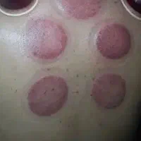 حجامت‌. ..گیرمالی