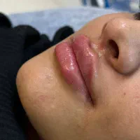 کلینیک زیبایی پوست و مو مایا|خدمات آرایشگری و زیبایی|ماهدشت, |دیوار