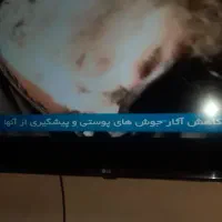 LG 43 LED SMART ال ای دی ال جی ۴۳