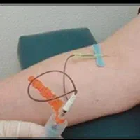 تزریقات آمپول سرم سوندشبانه روزی در منزل