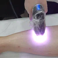 جشنواره پاییزه لیزرتضمینی موهای زائد