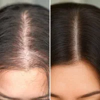 این اقدام آخریشه
