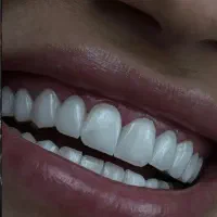 سلامت وزیبایی دندان