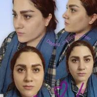تزریق ژل بوتاکس فیلر تخفیف ویژه|خدمات آرایشگری و زیبایی|تهران, سبلان (لشگر)|دیوار
