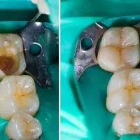 خدمات دندانپزشکی با بهترین کیفیت و پرداخت آسان|خدمات آرایشگری و زیبایی|اقلید, |دیوار