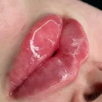 تزریق ژل وبوتاکس|خدمات آرایشگری و زیبایی|ساوه, |دیوار