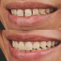دندانپزشکی گران نیست، غفلت گران است(نقد اقساط)|خدمات آرایشگری و زیبایی|شیراز, گلدشت معالی‌آباد|دیوار