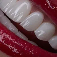 دندانپزشکی|خدمات آرایشگری و زیبایی|قم, عمار یاسر|دیوار