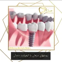 خدمات اقساطی دندانپزشکی