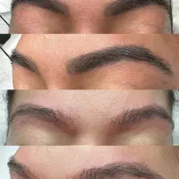 تخفیف ریمو (پاک کردن تتو) ابرو در کیلینیک زیبایی
