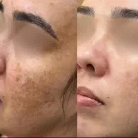 کرم های ما دستساز متخصص تهران