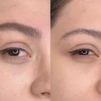 میکروبلیدینگ،فیبروز،میکروابرو.شیدینگ لب تخفیف ویژه