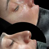 عمل زیبایی بینی ماموپلاستی ابدوپلاستی پروتز سینه