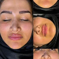نیازمند مدل خانوم بوتاکس و فیلر و ... بدون پرداختی