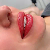 آموزش وخدمات فوق تخصصی میکرو میکرواسکالپ لیفت ابرو