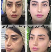جشنواره تخفیفات کلینیک پوست همراه با هدیه|خدمات آرایشگری و زیبایی|مشهد, کوه سنگی|دیوار