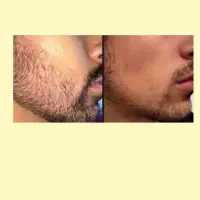 تغییر کن|آرایشی، بهداشتی، درمانی|تکاب, |دیوار