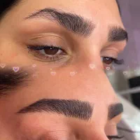 میکروبلیدینگ ابرور و فبیروز