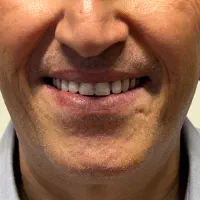 دندانسازی لبخند سیب|خدمات زیبایی و سلامت|تهران, صادقیه|دیوار
