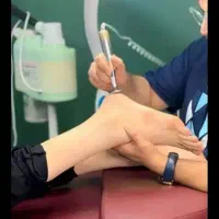 روشن سازی نقاط تیره بدن فیشال صورت پروتز کراتینه