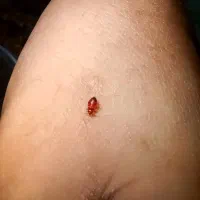 سمپاشی ساس ریشه کنی صددرصد بدون خطا