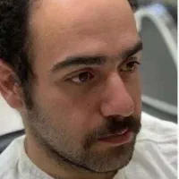 مرد کم مو و کچل