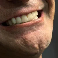دندان سالم،لبخند درخشان،تعرفه ها همچنان مناسب|خدمات آرایشگری و زیبایی|شیراز, نشاط|دیوار