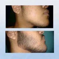 تا پر نشه زشته