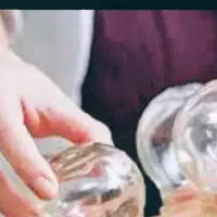 اموزش حجامت