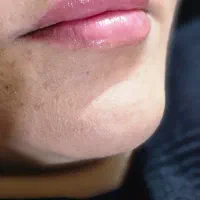 ژل وبوتاکس|خدمات آرایشگری و زیبایی|مشهد, ایثارگران|دیوار