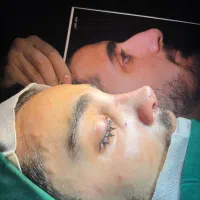 جراحی بینی ، کاشت مو، ایمپلنت، کامپوزیت|خدمات آرایشگری و زیبایی|تهران, یوسف‌آباد|دیوار