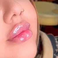 جشنواره  تزریق چربی لیزر لاغری ژل بوتاکس|خدمات آرایشگری و زیبایی|تهران, هفت حوض|دیوار