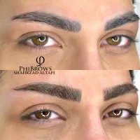 مدل میکروبلیدینگ تخصصی