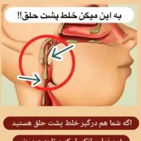 بلغم وسردی سر وبدن|آرایشی، بهداشتی، درمانی|اهواز, منازل کارون|دیوار