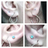 گوشواره طبی|آرایشی، بهداشتی، درمانی|بندر انزلی, میان پشته|دیوار