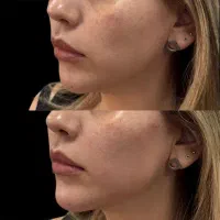 کلینیک زیبایی جراحی ژل بوتاکس غبغب فیلر لیزر مزو|خدمات آرایشگری و زیبایی|کرج, مهرویلا جنوبی|دیوار