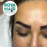 کاشت ابرو تضمینی توسط تکنولوژیست جراحی|خدمات آرایشگری و زیبایی|شیراز, چوگیاه‎|دیوار